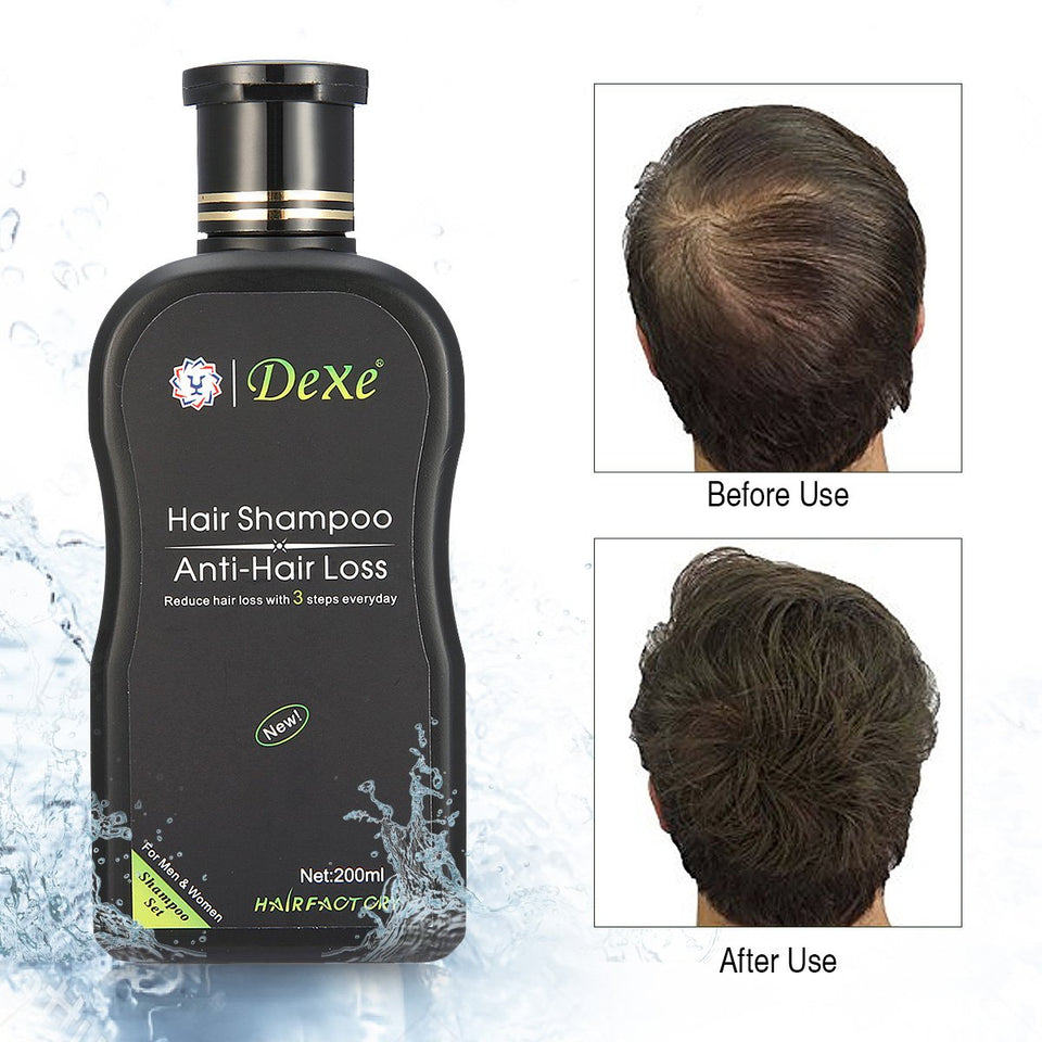 ANTI HAIR LOSS SHAMPOO