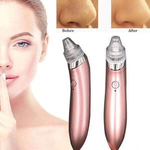 VACUUM PORE CLEANER