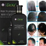 ANTI HAIR LOSS SHAMPOO